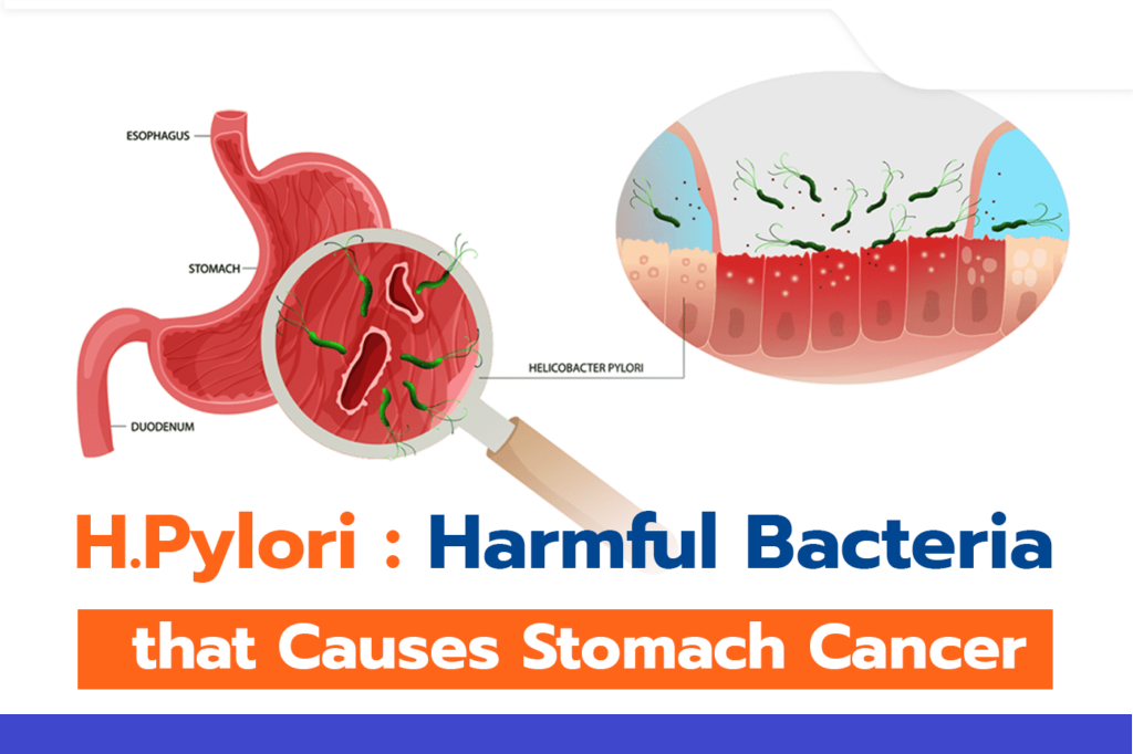 helicobacter Pylori